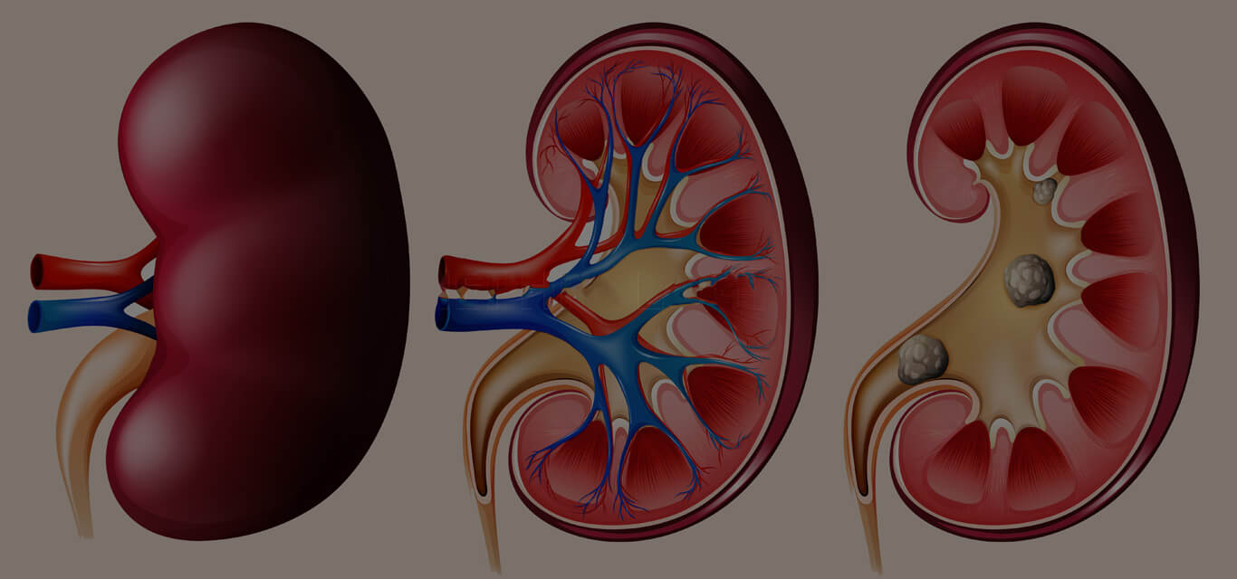 Nephrology and Urology